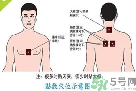 三伏貼能治頸椎病嗎？頸椎病三伏貼穴位