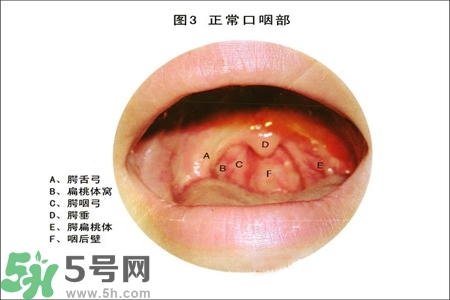 慢性咽炎的治療方法？慢性咽炎的藥物治療？