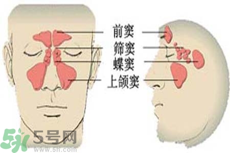 鼻竇炎是什么？鼻竇炎的癥狀有哪些？