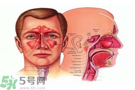 鼻竇炎是什么？鼻竇炎的癥狀有哪些？