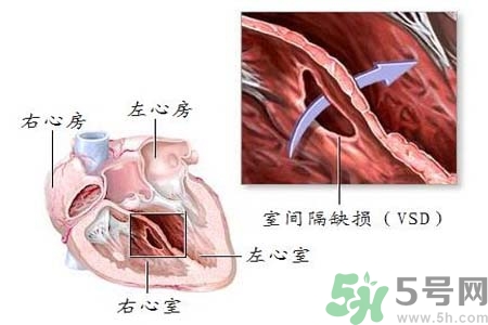 心臟病是怎么形成的？易發(fā)人群有哪些？