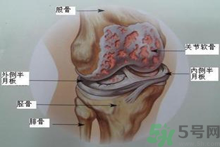 預(yù)防骨病需要注意哪些姿勢(shì)？秋季預(yù)防骨病的方法有哪些？