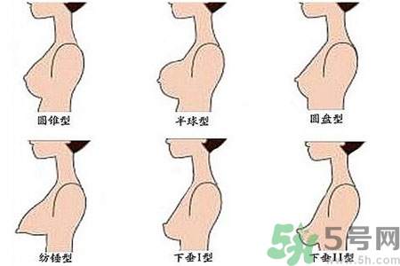 ?女性乳房下垂的原因是什么？女性乳房下垂的分類有哪些？