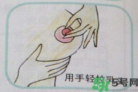 乳頭內(nèi)陷怎么矯正？乳頭內(nèi)陷矯正方法是什么？