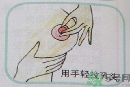 乳頭內(nèi)陷可以拔罐嗎？乳頭內(nèi)陷需要手術(shù)治療嗎？