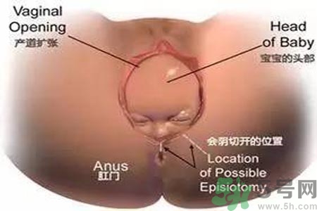 女性陰道松弛的原因是什么？女性陰道松弛怎么辦？