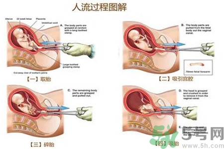 人流后怎么調(diào)養(yǎng)身體？人流后飲食需注意什么？