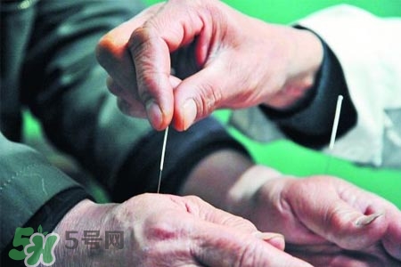 沒病可以針灸嗎？沒病可以扎針嗎？