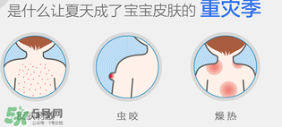 妙思樂爽膚水好用嗎？妙思樂爽膚水能去痱嗎？