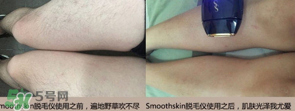 smoothskin和slikn infinity哪個好？smoothskin脫毛儀怎么樣