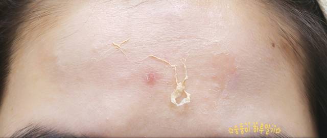 real skin patch怎么樣？real skin是什么牌子