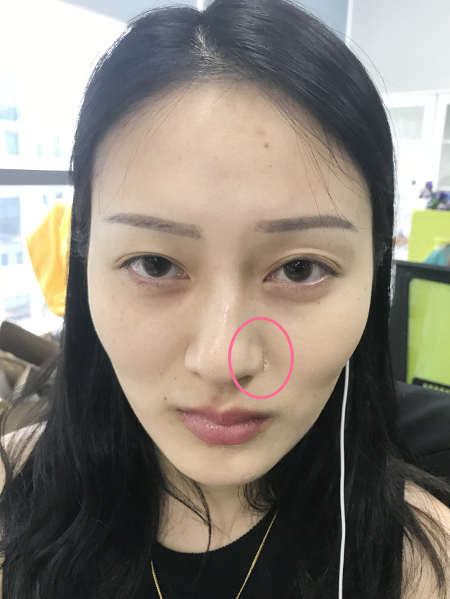 real skin patch怎么樣？real skin是什么牌子