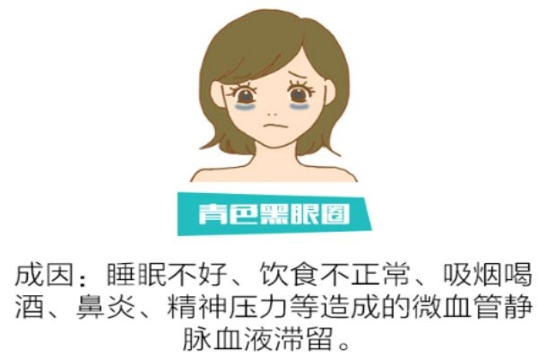 如何分辨黑眼圈類型 找對(duì)類型對(duì)癥下藥