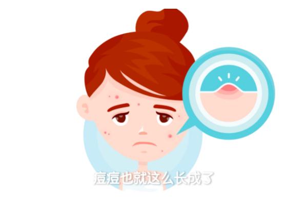 粉刺是痤瘡嗎 粉刺是螨蟲(chóng)造成的嗎